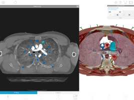 screen Human Anatomy Atlas 2020:&nbsp;Complete 3D Human Body