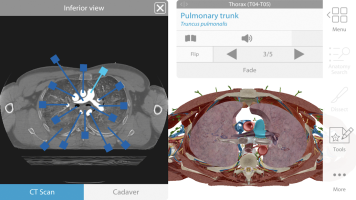 screen Human Anatomy Atlas 2020:&nbsp;Complete 3D Human Body